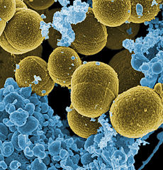 230px-Staphylococcus_aureus_bacteria_escape